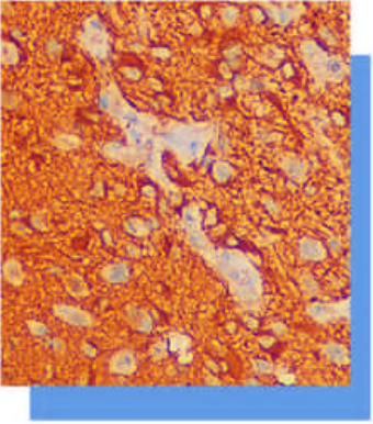 膠質纖維酸性蛋白（Glial Fibrillary Acidic Protein，GFAP）抗體試劑