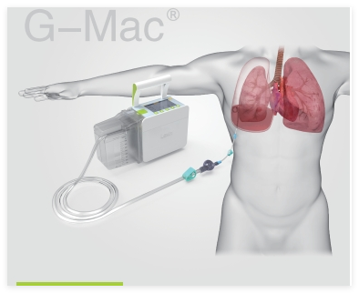 樂信 胸腔引流監控系統 G-Mac