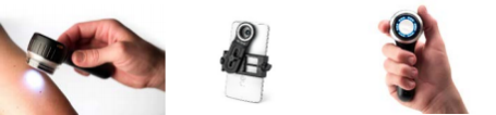  數碼皮膚鏡 MiiS Horus Scope DSC 100